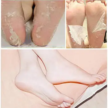 

Exfoliating Foot Peel Mask Peeling Off Calluses & Dead Skin Mask for Men & Women