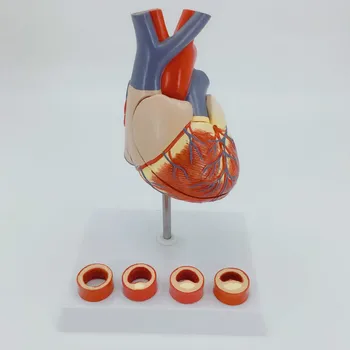 

1:1 Life Size Human Heart Anatomy Model with 4 Stage Vascular Mounted on White Base Cardiac Learn School Medical Teaching Model