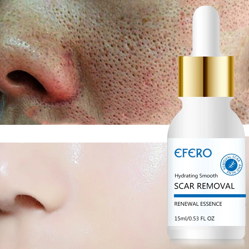 shrink pores shrink pores