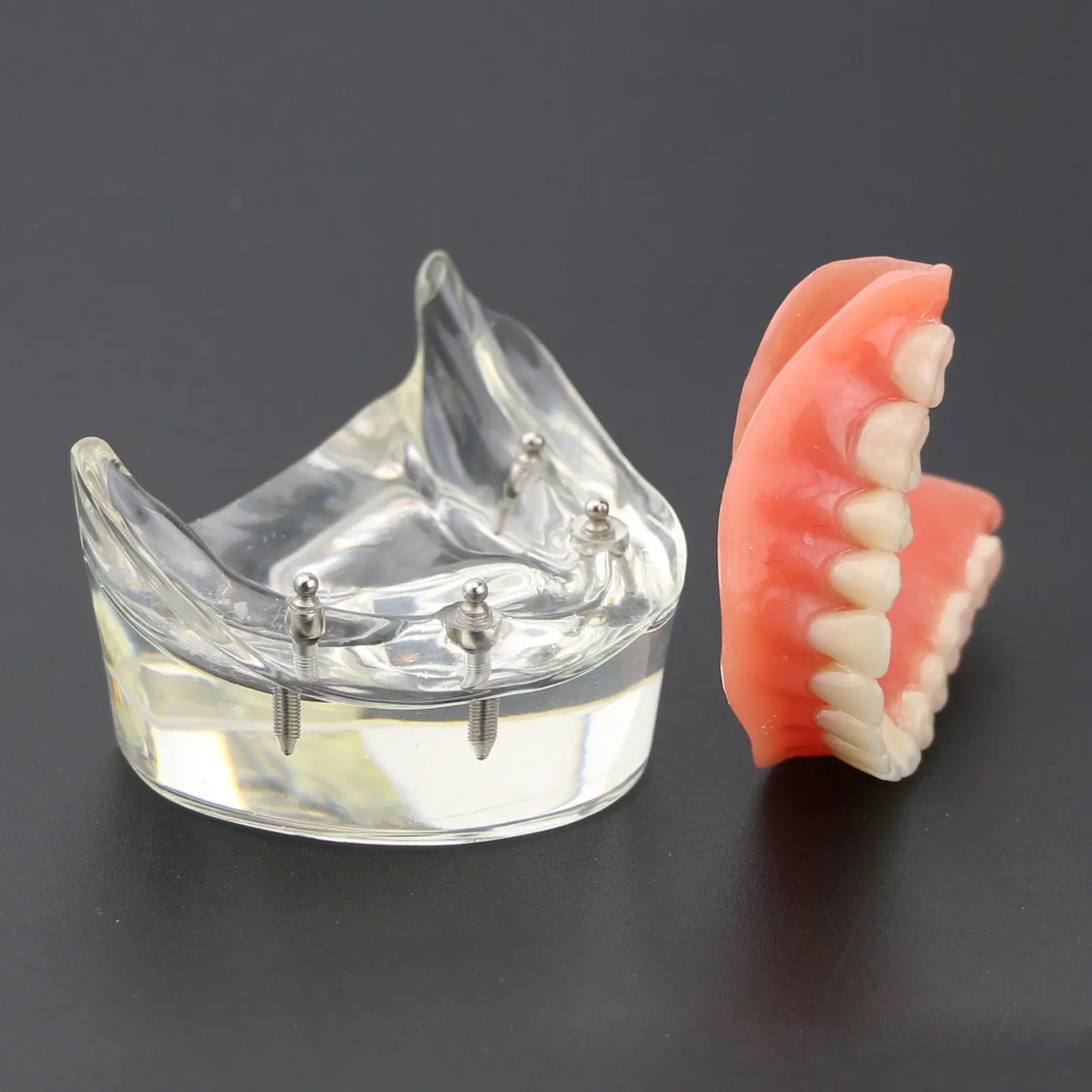 1 шт. стоматологическая модель исследования зубов сверхпротез низший 4 имплантата демонстрационная модель 6002 02