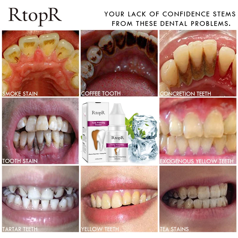 RtopR уход за зубами удаляет зубной налет пятна сыворотка отбеливание зубов отбеливающая пудра с эссенцией гигиена полости рта Чистящая вода 2 шт