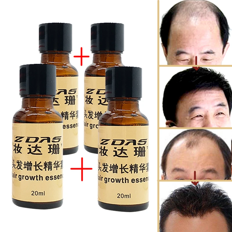 New Arrival Andrea Hair Growth Products Ginger oil Hair ...