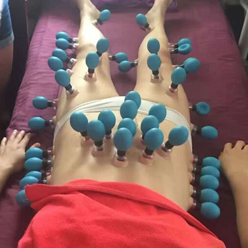 Household Vacuum Therapy Acupressure Cupping Set Suction Cup TCM Acupuncture Acupoint