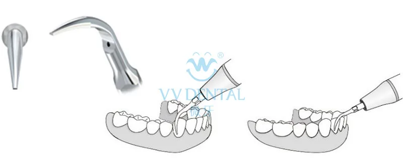 3 шт. GD1 Стоматологическая лабораторная продукция Стоматологическая игла насадки для инструмент дантиста, наконечник для NSK DTE Satelec стоматологический скалер наконечник
