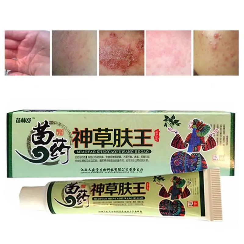 Natural Chinese Medicine Herbal Anti Bacteria Cream Psoriasis Eczema
