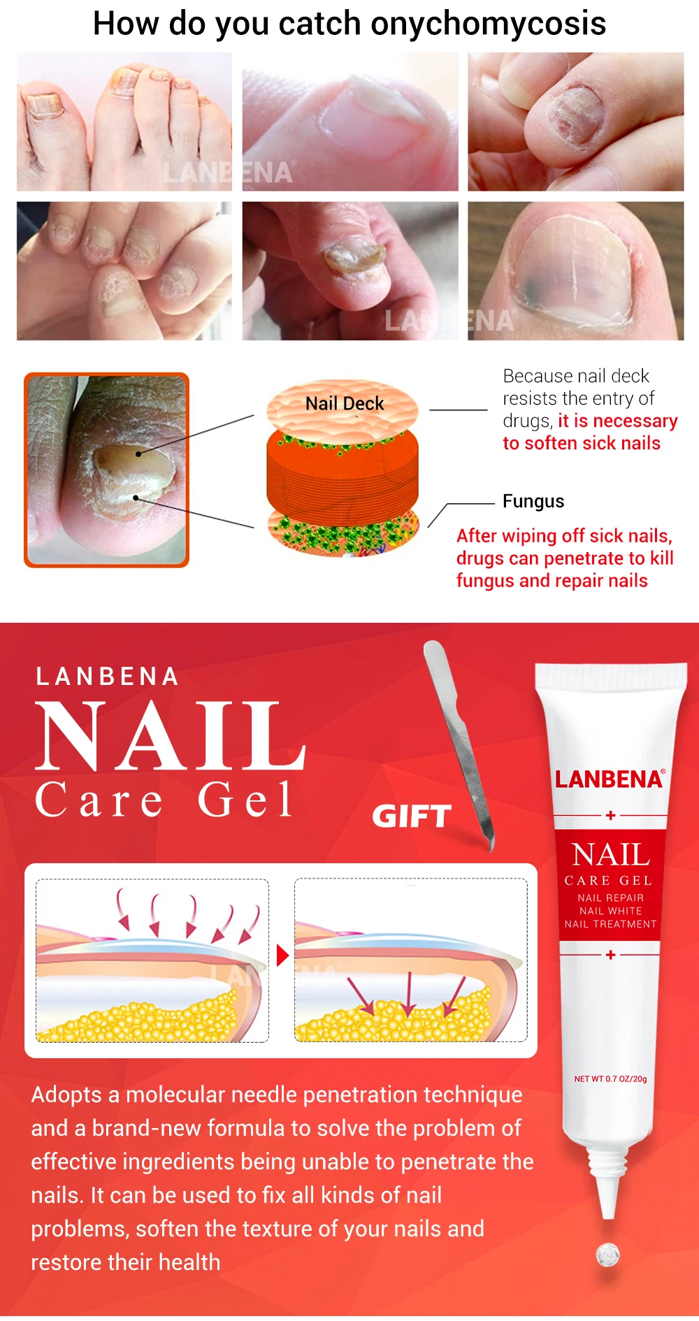LANBENA гель для ухода за ногтями+ восстанавливающая эссенция для ногтей, сыворотка для лечения Ногтей, удаление онихомикоза, Питательный Уход за ногтями для рук и ног, 2 шт