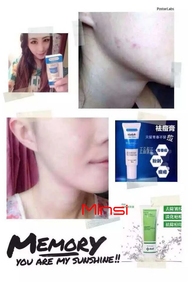 famous pimple cream