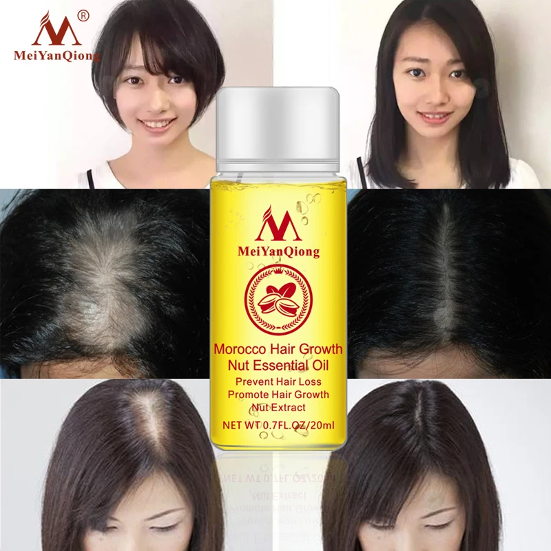 1 PCS Hair Growth Essence Hair Loss Liquid Natural Pure Nut Essential Oils Promote Hair Growth