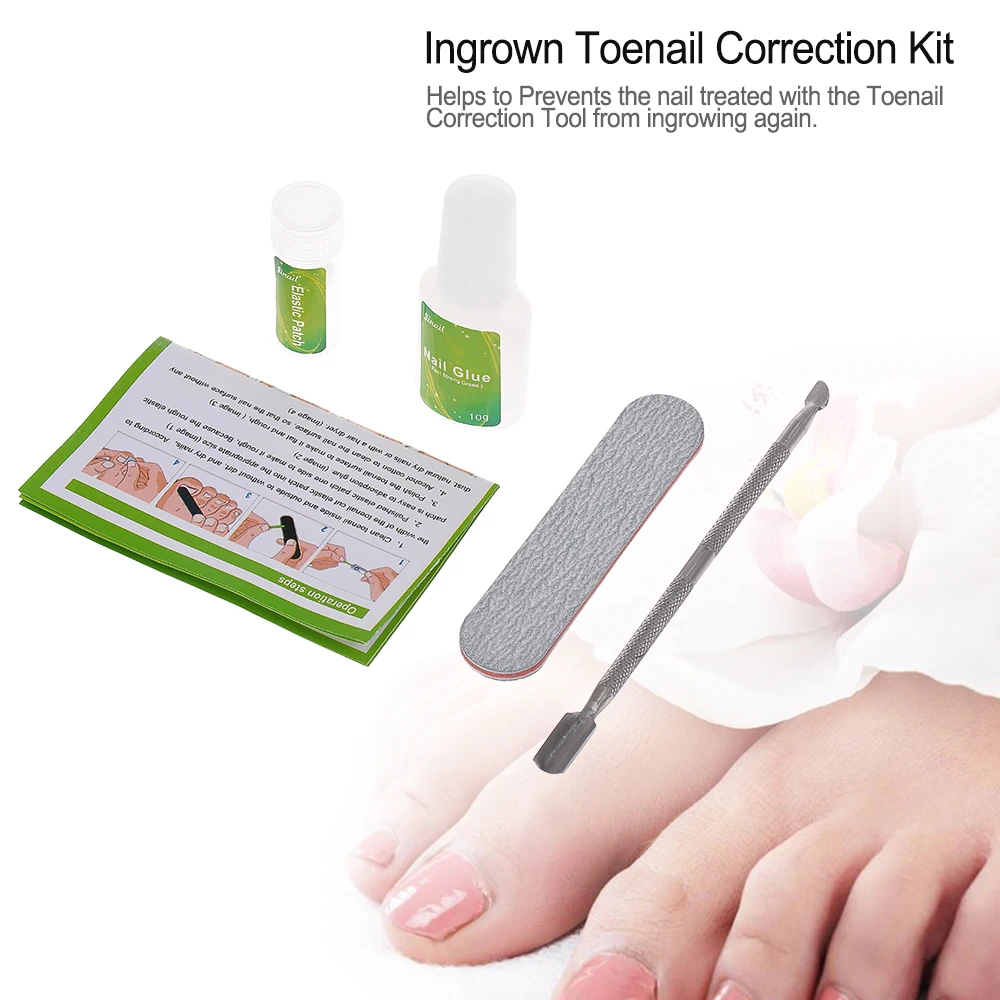 Ingrown Toenail Correction Kit Toenail Treatment With Glue Toenail