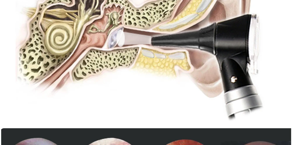 Профессиональный медицинский Otoscopio диагностический светодиодный отоскоп ушной заботы Домашний медицинский диагностический эндоскоп очиститель с 8 наконечниками