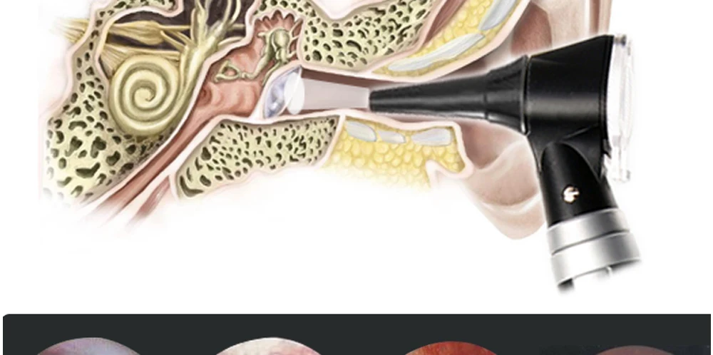 Медицинские Otoscopio диагностический светодиодный Лампы отоскоп ушной уход на дому профессиональный врач диагностики уха эндоскоп Cleaner с 8 советов