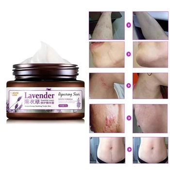 

New Lavender Hyaluronic Acid Scar Removal Cream Serum Repair Treatment Skin Care
