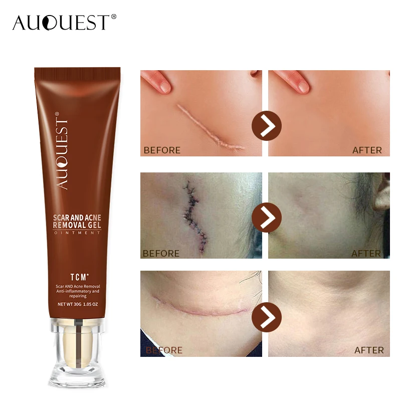 old scar treatment