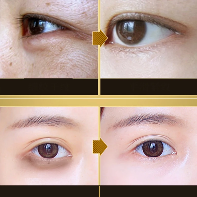 Fonce Korean Collagen Seaweed Crystal Eye Patches 60 piece Reduce Dark circles Gel Eye Care Sleep Masks Anti Age Bag Eye Wrinkle