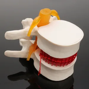 Image 4 - Anatomia człowieka szkielet kręgosłupa dysk lędźwiowy przepuklina model nauczania mózg czaszka traumatyczne pistolet szkolne medyczne instrume