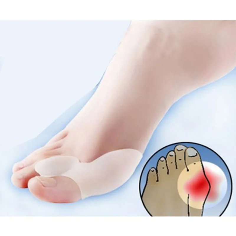 4pc hallux valgus corrector corrects foot type without pain Herramienta de pie Enderezadora 4pc hallux valgus corrector corrects foot type without pain Herramienta de pie Enderezadora