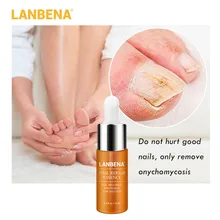 LANBENA средство для удаления онихомикоза для пальцев ног питательное осветление для рук и ног Уход за ногтями восстанавливающая эссенция сыворотка лечение грибковых ногтей
