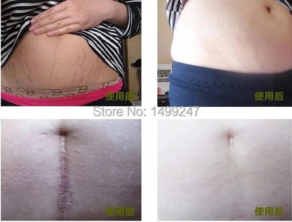 How long should i jump rope to lose weight yahoo picture 4