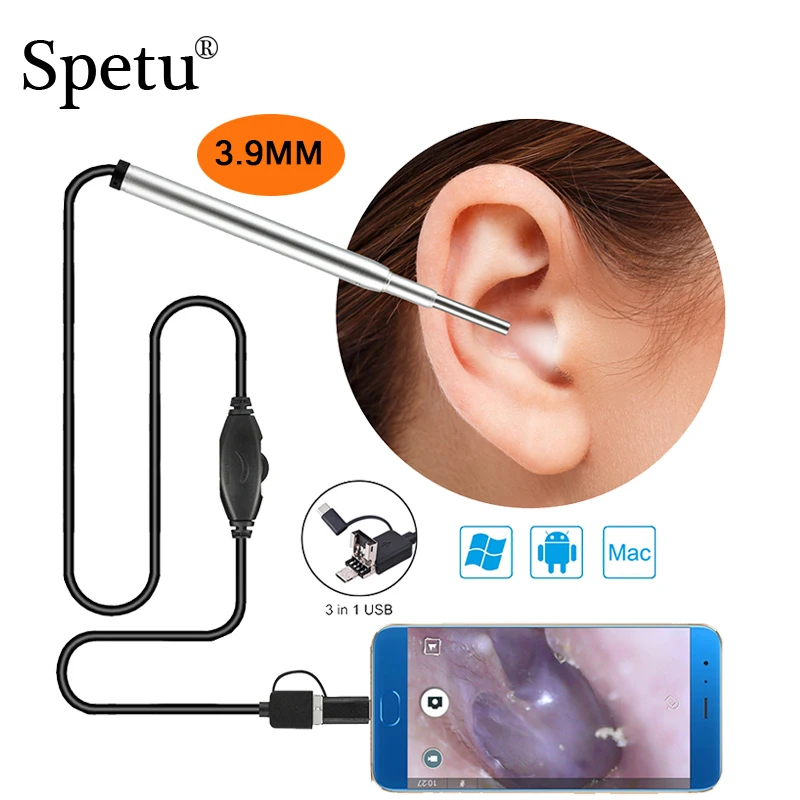 Spetu 3.9mm HD 720P 3IN1 USB Medical Endoscope Ear Otoscope Camera
