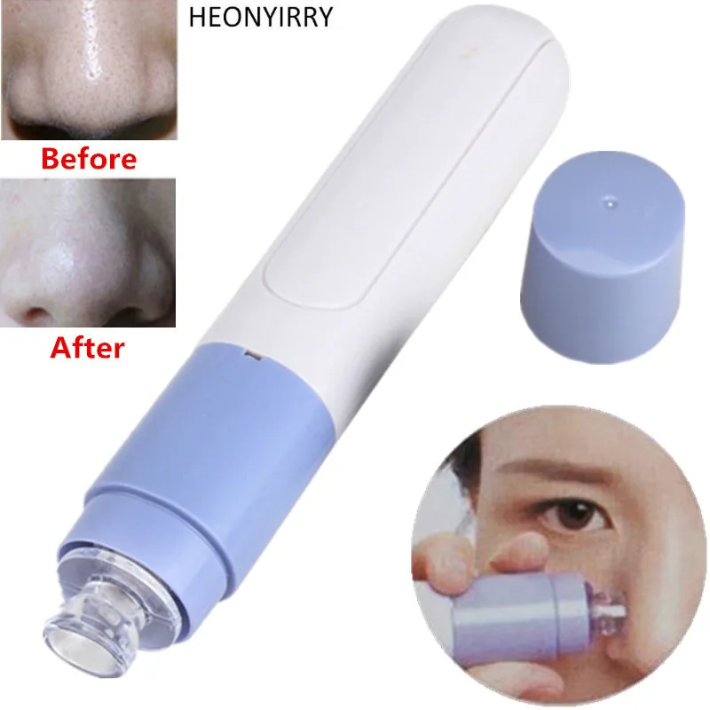 Electric Facial Pore Cleanser Skin Cleaner Face Dirt Suck Up Pore Vacuum Acne Pimple Tool Vacuum Tools Blackhead Removers Electric Facial Pore Cleanser Skin Cleaner Face Dirt Suck Up Pore Vacuum Acne Pimple Tool Vacuum Tools Blackhead Removers