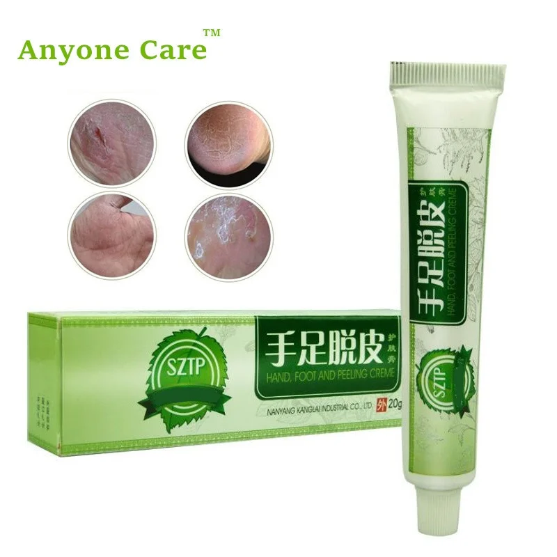 Anti Cracked Hands and Feet cracked Chinese Medical Ointment Hand Foot