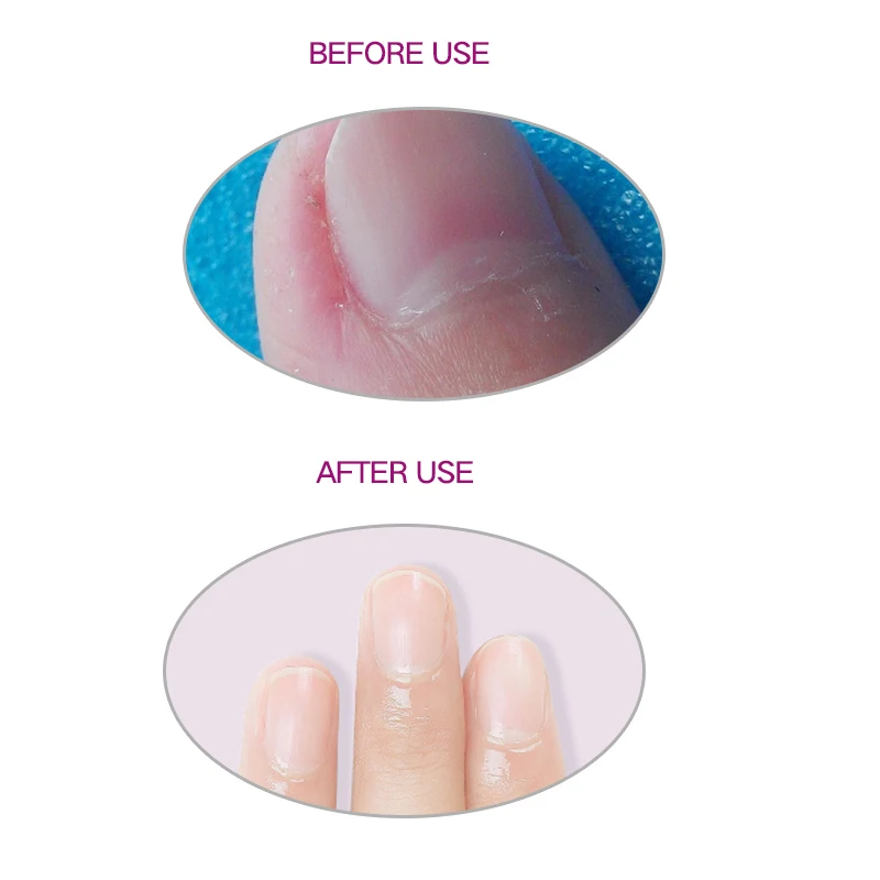Yinikiz ногти для защиты кожи прозрачный розовый кутикол ногтей масло