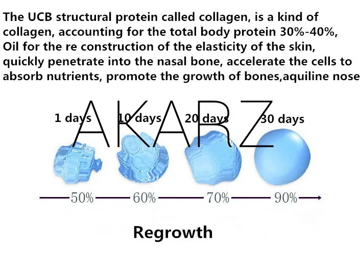 AKARZ от известного бренда, эфирные масла, увеличивающие рост носа, Ремоделирование носовой кости, уход за носом, тонкое масло для носа меньшего размера