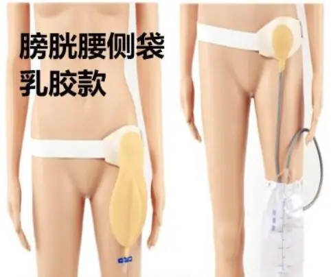 waist side urine bag latex unilateral urinary tract urinary bag urinal ostomy urine collection