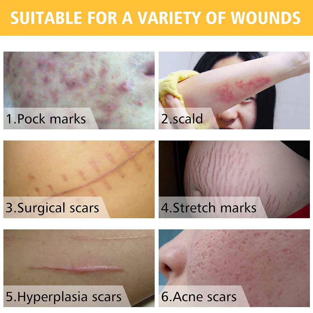 Face Care Essential Oil Acne Scar Spots Removal Skin Care Whitening Remove Scars Acne Repair Face 2