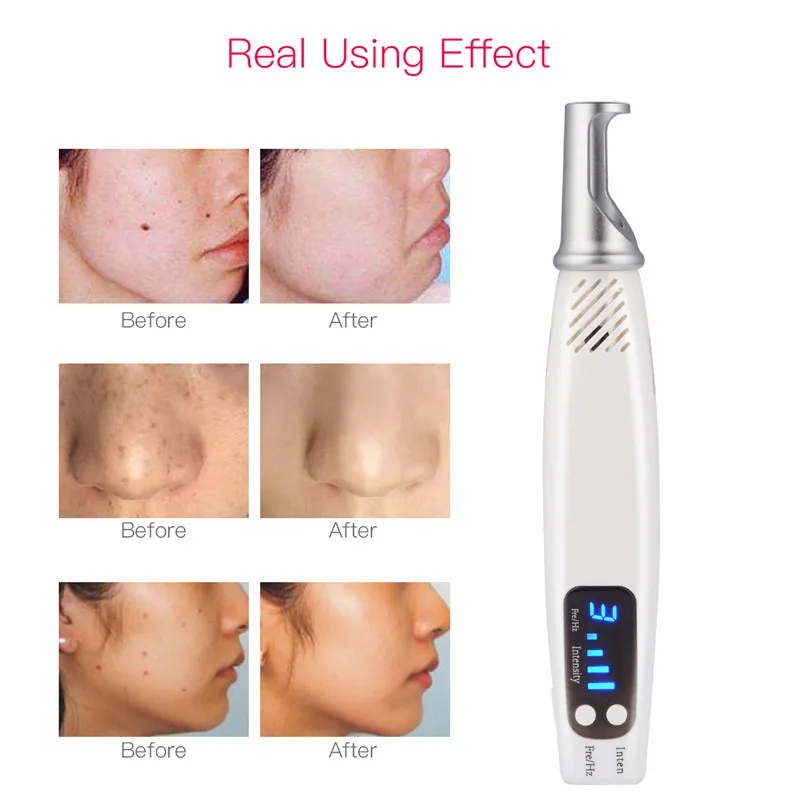 

Handheld Laser Heat Picosecond Pen Scar Mole Freckle Dark Spot Acne Treatment Eyebrow Tattoo Removal Machine Beauty Care P63