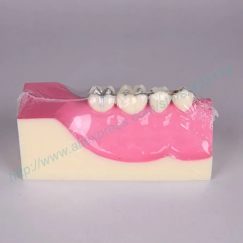 Molar cross section study model 01