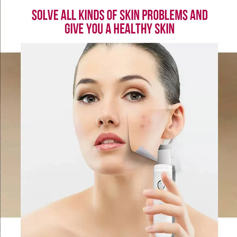 

Ultrasonic Ion Skin Scrubber Facial Care Ultrasonic Scrubber Cleaner Blackhead Removal Face Peeling Extractor Skin Beauty Device