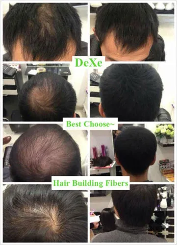 HB-HairFiber01-22G16-1