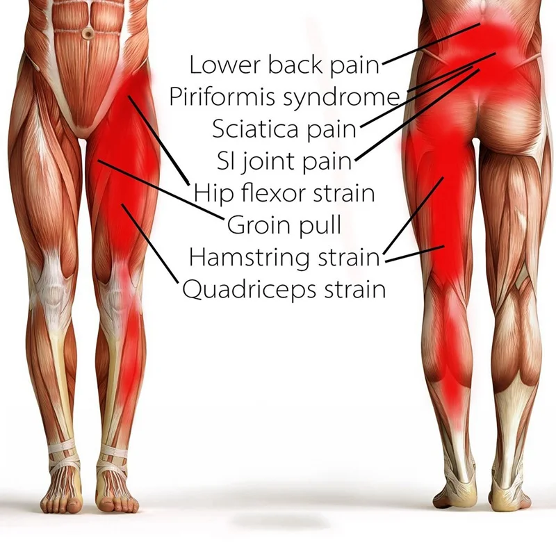 Компрессионная обмотка для паха бедра Quad Hamstring суставов Sciatica нерва облегчение боли ремень, регулируемая поддержка скоба