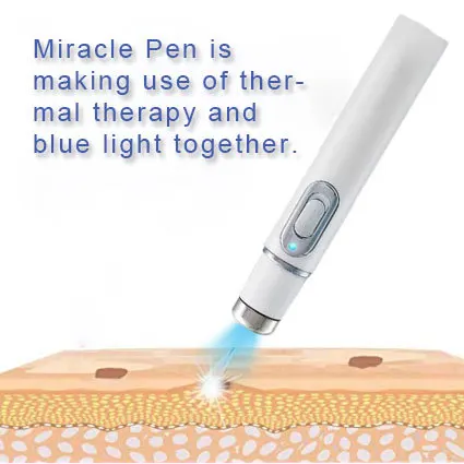 Abay от акне лазерная ручка портативный аппарат мягкий шрам устройство синий свет терапия ручка массаж глаз удаляет мешки для глаз темные