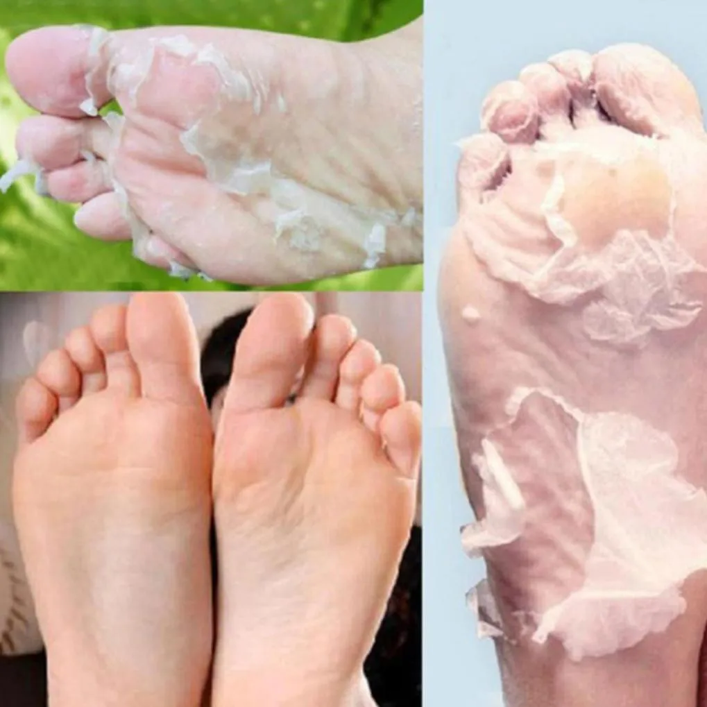 

Dazzling Girl Store Health and Beauty Olives Hot Remove Dead Skin Foot Mask Peeling Cuticles Heel Feet Care Anti Aging