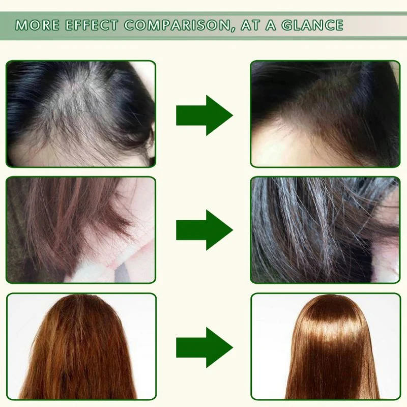 Марокканское аргановое масло уход за волосами эссенция быстрая мощная жидкость для роста волос выпадение волос сыворотка ремонт волос