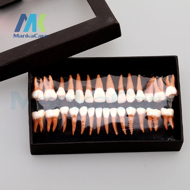 dents-dentaires-permanentes-pour-adultes-28-pieces-1-1-modeles-de-dents-pour-adultes-cadeau-pour-un-mois-complet-communication-verisimetrie-odontologia