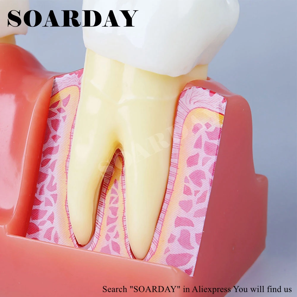 1 шт. 4 раза стоматологический Анализ зубов Модель разложения дисплей форма зуба и внутренняя структура