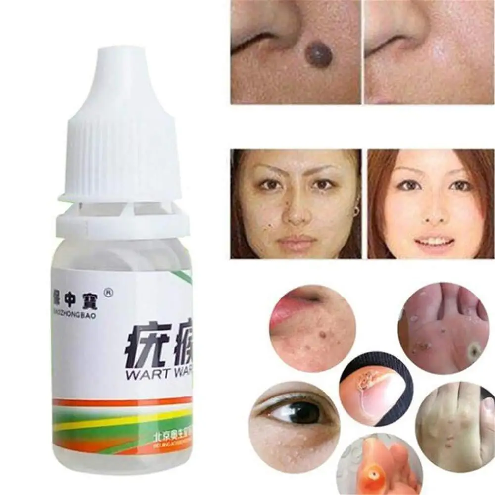 Foot Care Tools Skin Tag Remover Body Warts Treatment Foot Corn Removal Plantar Warts Ointment Foot Care Medical Plaster