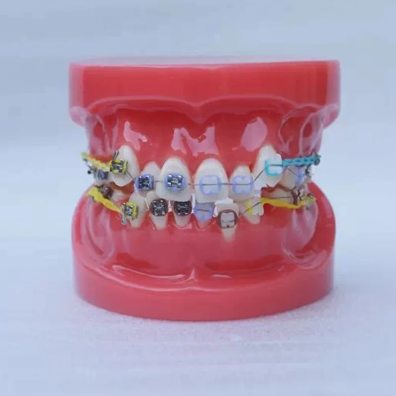 

24pcs Teeth half metal and half ceramic bracket Orthodontics Dental Model