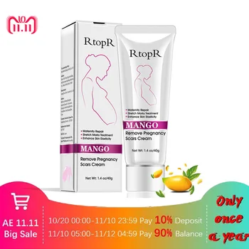 

Acne Cream Stretch Marks Treatment Maternity Repair Anti-Aging Anti Winkles Firming Body Creams Remove Pregnancy Scars