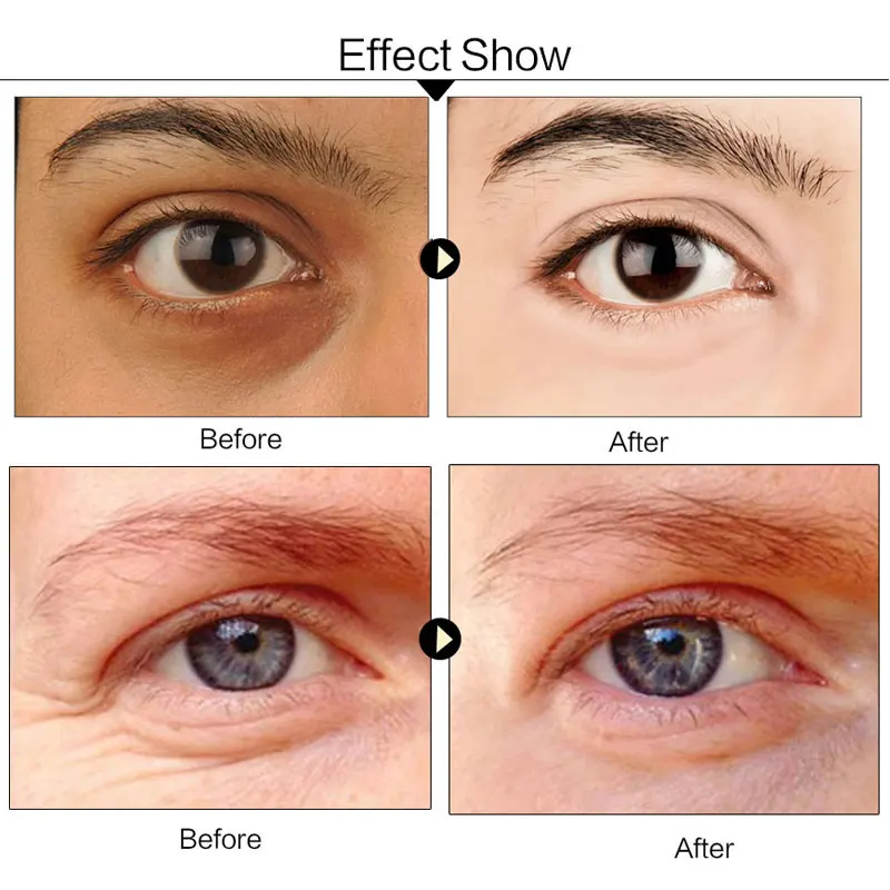 EFERO 5Packs Collagen Eye Mask Dark Circles Repair Anti-Aging Crystal Gel Eye Patch Black Sheet Mask for Eye Patches Skin Care EFERO 5Packs Collagen Eye Mask Dark Circles Repair Anti-Aging Crystal Gel Eye Patch Black Sheet Mask for Eye Patches Skin Care