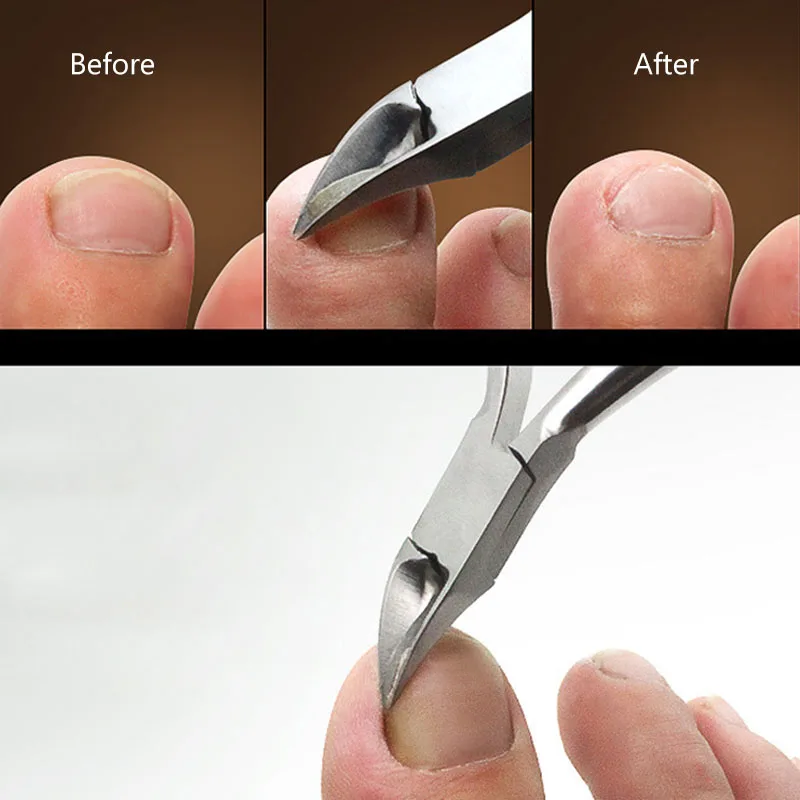Высокое качество щипцы для кутикулы Clipper плоскогубцы-ножницы мертвая кожа