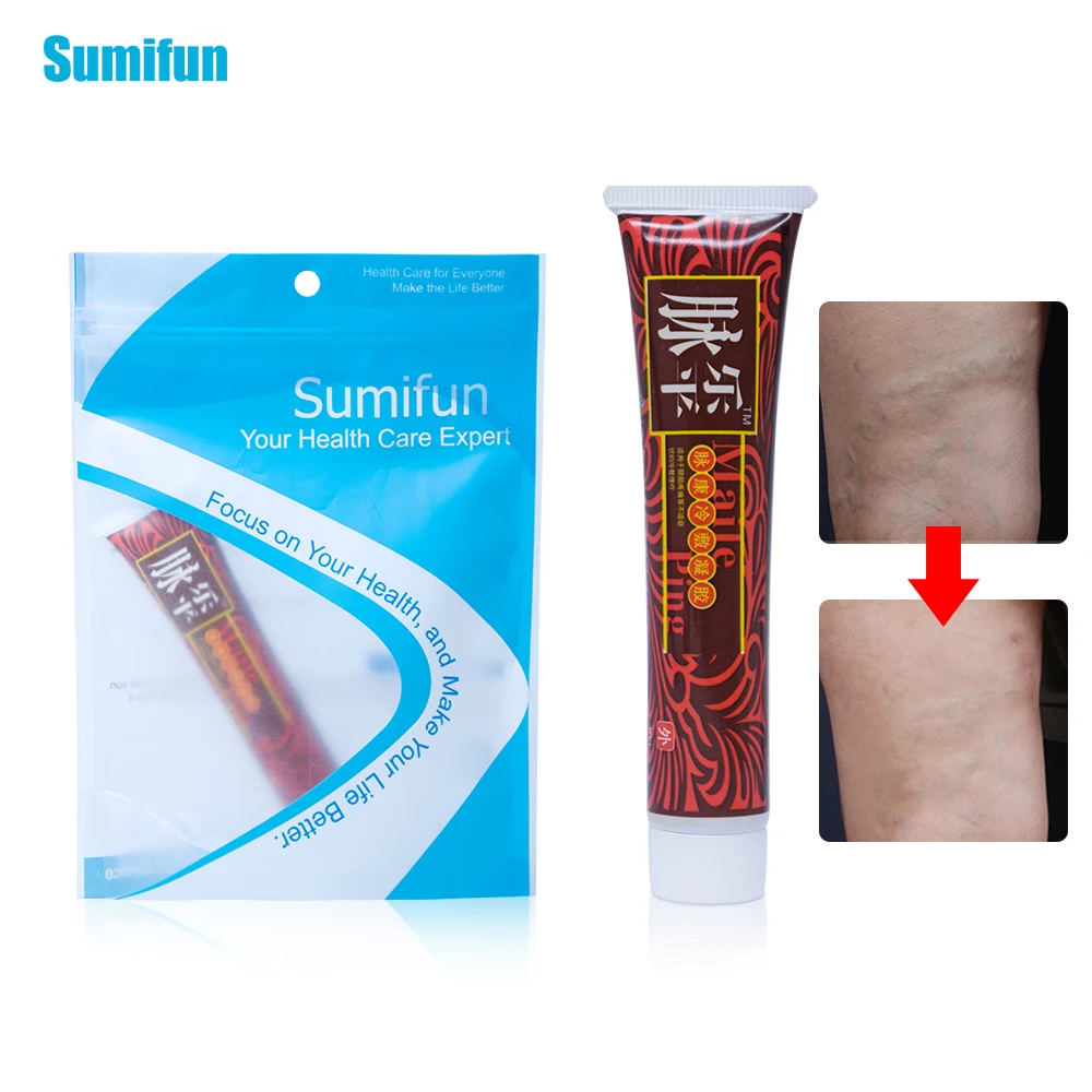 Sumifun 1 шт. мягкая мазь искусственное лечение флебит паук боль варикозный ангиит
