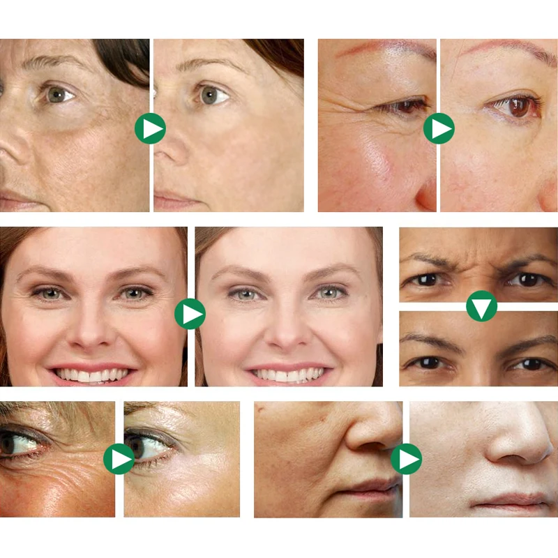 Argireline Face Serum Collagen Anti-wrinkle Anti-aging Essence Hyaluronic Acid Moisturizing Whitening Face Skin Care IMAGES 10ML