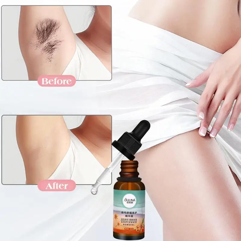 

Hair Removal Hyaluronic Acid Cream Hair Growth Inhibitor Painless Depilatory for Leg Body Armpit Hands Body Depilation Serum