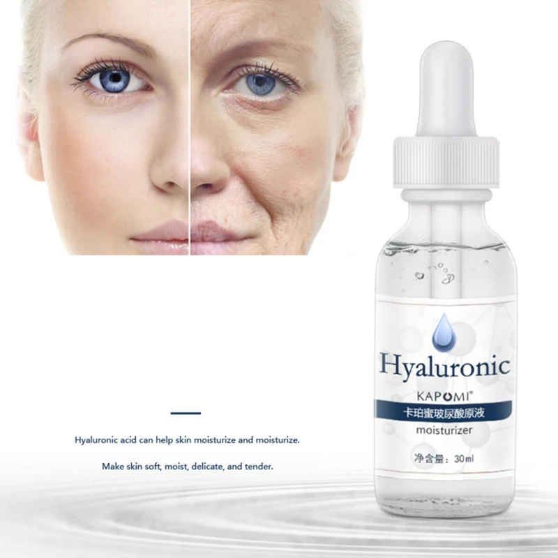 винное лицо. гиалуроновая кислота для лица процедуры. биоревитализация до и после. гиалуроновой кислоты для лица уколы до и после лицо. лицо до и после инъекции.