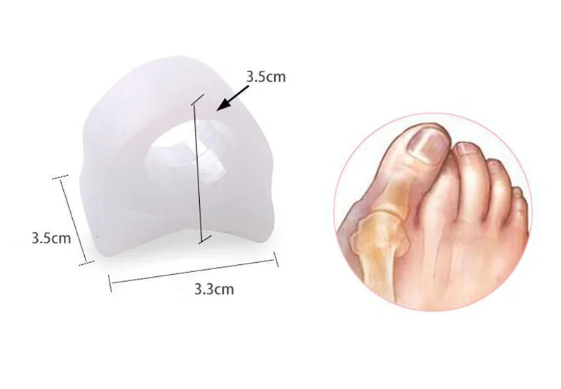 HANRIVER 5 шт. в силиконовый ортопедический корректор для косточки большого пальца ноги костюм носок разделитель правильные коврики каждый
