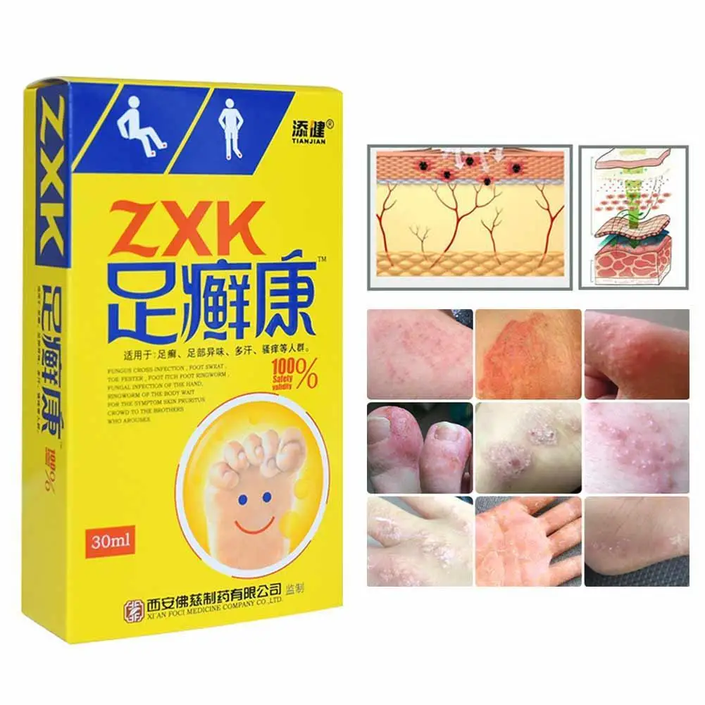 

Herbal Anti-fungi Athlete Foot Spray Foot Care Antibacterial Deodorant Powder Anti Itch Sweat Odor Feet Liquid Anti-fungi Spray